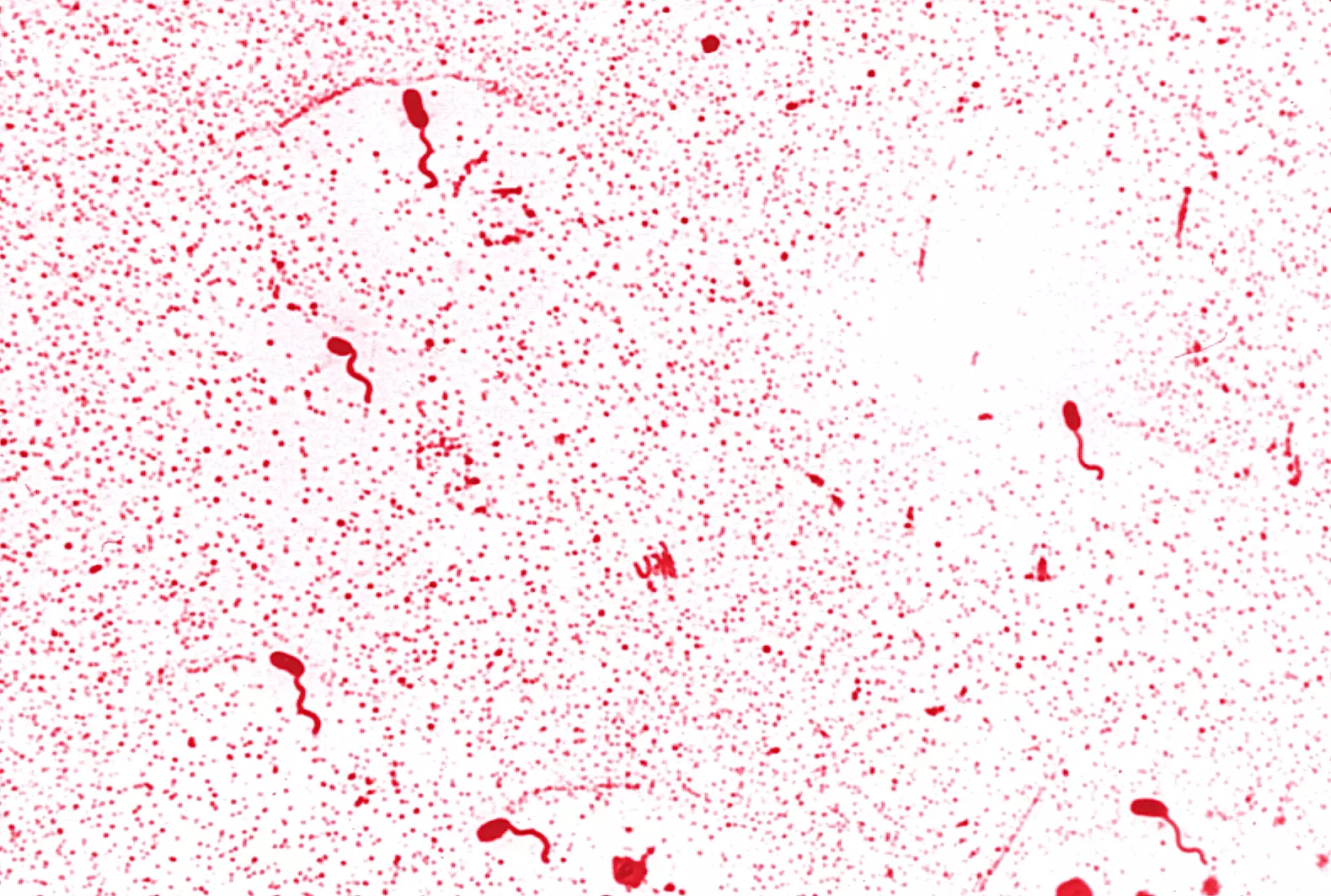 La bactérie Vibrio Cholerae