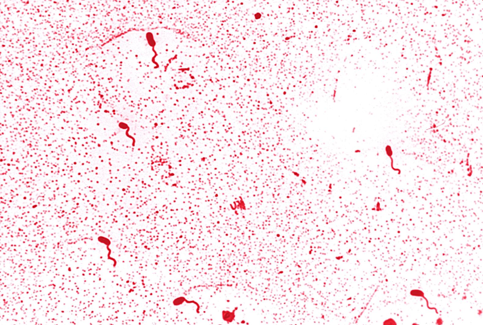 La bactérie Vibrio Cholerae